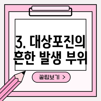 3. 대상포진의 흔한 발생 부위